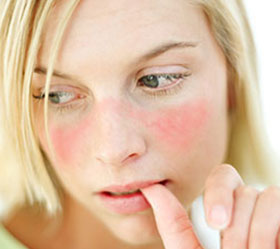 Cutaneous-rash-thumbnail